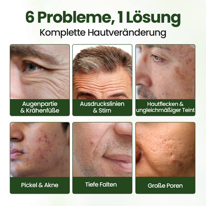 Biancat® FortiTallow Anti-Falten-Balsam