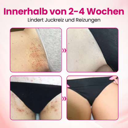 Timilk® IntiDefend Anti-HPV Interferon-Gel