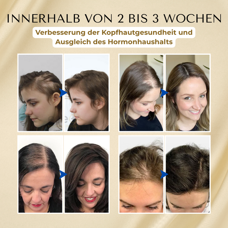 Timilk® VitaStrand Biotin Haarwachstumsspray