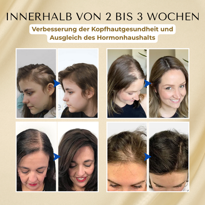 Timilk® VitaStrand Biotin Haarwachstumsspray