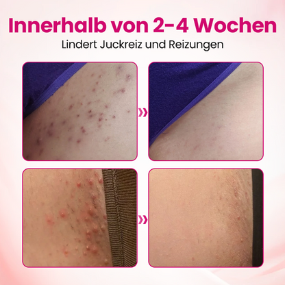 Timilk® IntiDefend Anti-HPV Interferon-Gel