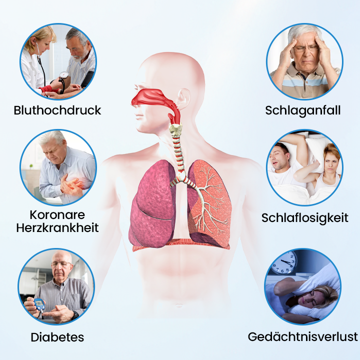 Timilk® SnoreLess Nasenatmungshelfer